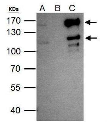 Immunoprecipitation: SETDB2 Antibody [NBP2-20323] -  HeLa whole cell lysate/extract A. 40 ug HeLa whole cell lysate/extract B. Control with 2 ug of preimmune rabbit IgG C. Immunoprecipitation of SETDB2 protein by 2 ug of SETDB2 antibody 7.5% SDS-PAGE The immunoprecipitated SETDB2 protein was detected by SETDB2 antibody diluted at 1:1000. EasyBlot anti-rabbit IgG was used as a secondary reagent.