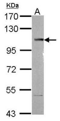 Western Blot: SETDB2 Antibody [NBP2-20323] - Sample (30 ug of whole cell lysate) A: SK-N-SH 7. 5% SDS PAGE gel, diluted at 1:1000.