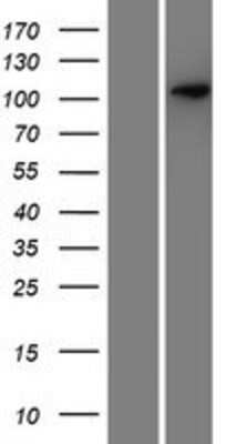 Western Blot SEZ6/BSRP-C Overexpression Lysate