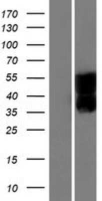 Western Blot: SEZ6L Overexpression Lysate (Adult Normal) [NBP2-10262] Left-Empty vector transfected control cell lysate (HEK293 cell lysate); Right -Over-expression Lysate for SEZ6L.