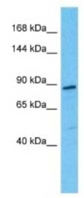 Western Blot: SEZ6L2/BSRP-A Antibody [NBP3-09952] - Western blot analysis of SEZ6L2/BSRP-A in Fetal Kidney lysates. Antibody dilution at 1ug/ml