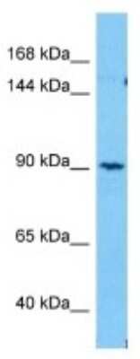 Western Blot: SEZ6L2/BSRP-A Antibody [NBP3-10995] - Western blot analysis of SEZ6L2/BSRP-A in Human 786-0 Whole Cell lysates. Antibody dilution at 3ug/ml