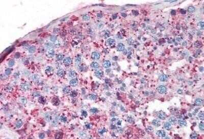 Immunohistochemistry-Paraffin: SF-1/NR5A1/Steroidogenic Factor 1 Antibody - BSA Free [NBP1-02349] - Staining of human testis.