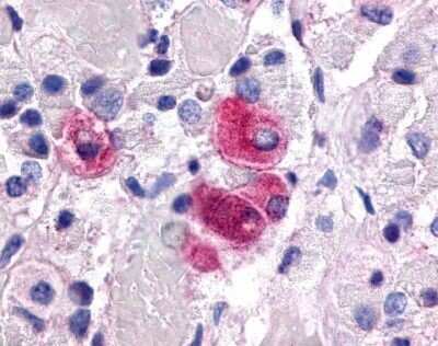 Immunohistochemistry-Paraffin: SF-1/NR5A1/Steroidogenic Factor 1 Antibody [NLS2479] - Analysis of brain, pituitary using NLS2479 at 15 ug/ ml.