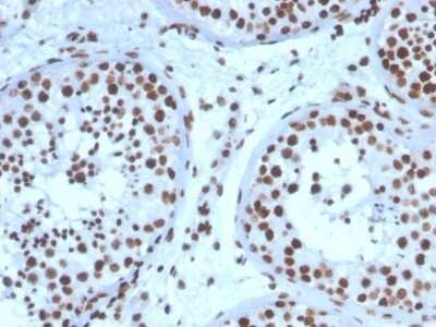 Immunohistochemistry-Paraffin: SF-1/NR5A1/Steroidogenic Factor 1 Antibody (NR5A1/3397) [NBP3-08624] - Formalin-fixed, paraffin-embedded human testis stained with SF-1/NR5A1/Steroidogenic Factor 1 Mouse Monoclonal Antibody (NR5A1/3397).