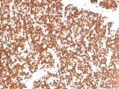Immunohistochemistry-Paraffin: SF-1/NR5A1/Steroidogenic Factor 1 Antibody (NR5A1/3397) [NBP3-08624] - Formalin-fixed, paraffin-embedded human thymus stained with SF-1/NR5A1/Steroidogenic Factor 1 Mouse Monoclonal Antibody (NR5A1/3397).
