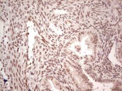 Immunohistochemistry: SF-1/NR5A1/Steroidogenic Factor 1 Antibody (OTI1B4) - Azide and BSA Free [NBP2-74149] - Analysis of Human endometrium tissue. (Heat-induced epitope retrieval by 1 mM EDTA in 10mM Tris, pH8.5, 120C for 3min)