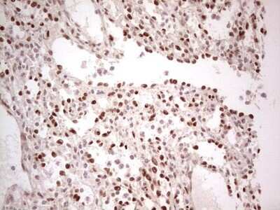 Immunohistochemistry: SF-1/NR5A1/Steroidogenic Factor 1 Antibody (OTI1B4) - Azide and BSA Free [NBP2-74149] - Analysis of Human lymph node tissue. (Heat-induced epitope retrieval by 1 mM EDTA in 10mM Tris, pH8.5, 120C for 3min)