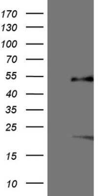 Western Blot: SF-1/NR5A1/Steroidogenic Factor 1 Antibody (OTI1B4) - Azide and BSA Free [NBP2-74149] - Analysis of HEK293T cells were transfected with the pCMV6-ENTRY control (Left lane) or pCMV6-ENTRY NR5A1.