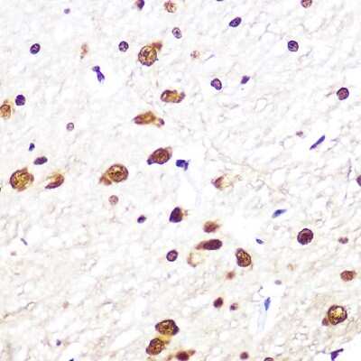 Immunohistochemistry-Paraffin: SF2 Antibody (8L3T3) [NBP3-16329] - Immunohistochemistry of paraffin-embedded rat brain using SRSF1/SF2 Rabbit mAb (NBP3-16329) at dilution of 1:100 (40x lens).Perform microwave antigen retrieval with 10 mM PBS buffer pH 7.2 before commencing with IHC staining protocol.