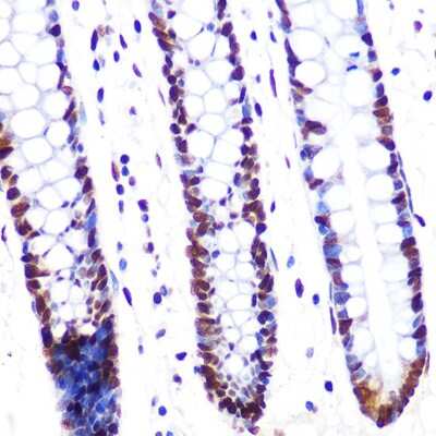 Immunohistochemistry-Paraffin: SF2 Antibody (8L3T3) [NBP3-16329] - Immunohistochemistry of paraffin-embedded human colon using SRSF1/SF2 Rabbit mAb (NBP3-16329) at dilution of 1:100 (40x lens).Perform microwave antigen retrieval with 10 mM PBS buffer pH 7.2 before commencing with IHC staining protocol.