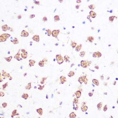 Immunohistochemistry-Paraffin: SF2 Antibody (8L3T3) [NBP3-16329] - Immunohistochemistry of paraffin-embedded mouse brain using SRSF1/SF2 Rabbit mAb (NBP3-16329) at dilution of 1:100 (40x lens).Perform microwave antigen retrieval with 10 mM PBS buffer pH 7.2 before commencing with IHC staining protocol.