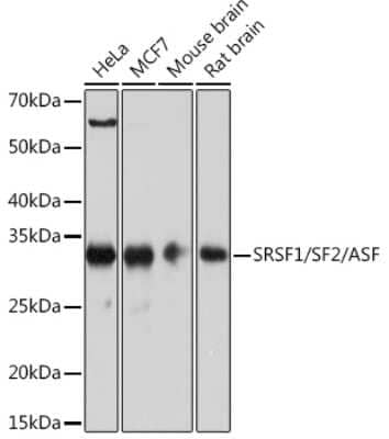 Western Blot: SF2 Antibody (8L3T3) [NBP3-16329] - Western blot analysis of extracts of various cell lines, using SRSF1/SF2 Rabbit mAb (NBP3-16329) at 1:1000 dilution. Secondary antibody: HRP Goat Anti-Rabbit IgG (H+L) at 1:10000 dilution. Lysates/proteins: 25ug per lane. Blocking buffer: 3% nonfat dry milk in TBST. Detection: ECL Basic Kit. Exposure time: 3s.