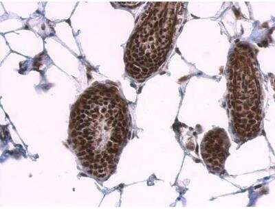 Immunohistochemistry-Paraffin: SF2 Antibody [NBP2-20324] - Paraffin-embedded mouse skin. SF2 antibody dilution: 1:500.