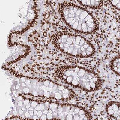 Immunohistochemistry-Paraffin: SF2 Antibody [NBP2-38912] - Staining of human colon shows strong nuclear positivity in glandular cells.