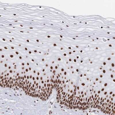 Immunohistochemistry-Paraffin: SF2 Antibody [NBP2-38912] - Staining of human cervix, uterine shows strong nuclear positivity in squamous epithelial cells.