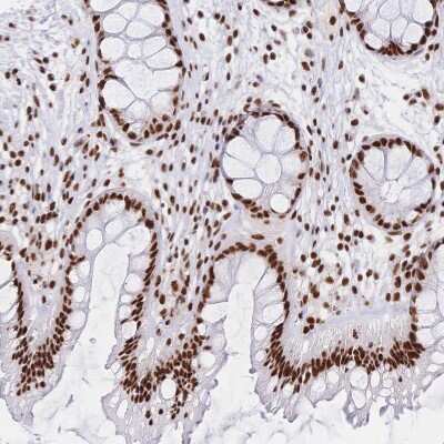 Immunohistochemistry-Paraffin: SF2 Antibody [NBP2-38912] - Staining of human rectum shows strong nuclear positivity in glandular cells.