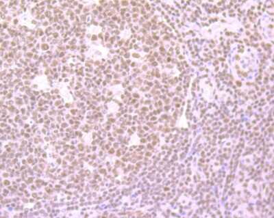 Immunohistochemistry-Paraffin: SF2 Antibody (JB40-76) [NBP2-75663] - Analysis of paraffin-embedded human tonsil tissue using anti-SF2 antibody. Counter stained with hematoxylin.