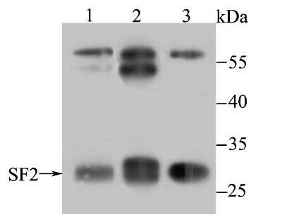 Western Blot: SF2 Antibody (JB40-76) [NBP2-75663] - Analysis of SF2 on different lysates using anti-SF2 antibody at 1/500 dilution.Positive control:Lane 1: Mouse heart    Lane 2: Mouse liverLane 3: K562