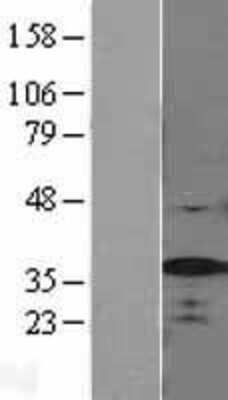 Western Blot: SF2 Overexpression Lysate (Adult Normal) [NBL1-15886] Left-Empty vector transfected control cell lysate (HEK293 cell lysate); Right -Over-expression Lysate for SF2.