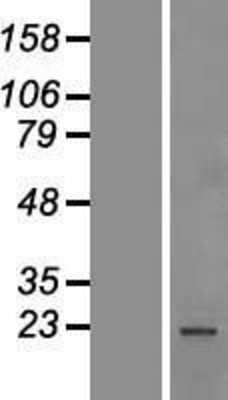 Western Blot: SF2 Overexpression Lysate (Adult Normal) [NBP2-10637] Left-Empty vector transfected control cell lysate (HEK293 cell lysate); Right -Over-expression Lysate for SF2.