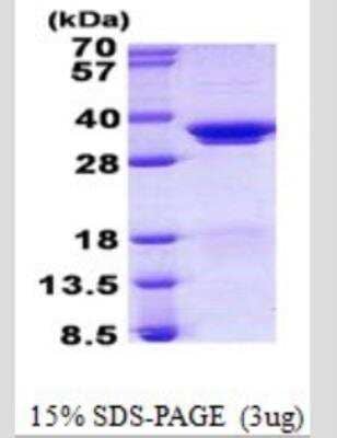 SDS-Page: SF2 Protein [NBP2-53109]