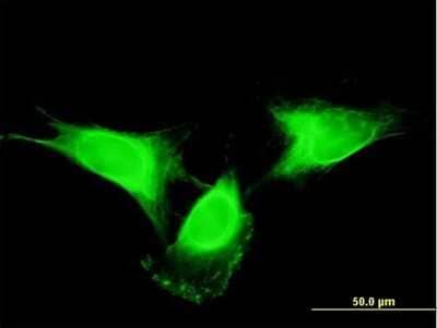 Immunocytochemistry/Immunofluorescence: SF20/MYDGF Antibody (2D4) [H00056005-M03] - Analysis of monoclonal antibody to SF20/MYDGF on HeLa cell. Antibody concentration 10 ug/ml