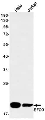 Western Blot: SF20/MYDGF Antibody (S06-7B1) [NBP3-20063] - Western blot detection of SF20/MYDGF in Hela, Jurkat cell lysates using NBP3-20063 (1:1000 diluted). Predicted band size: 19kDa. Observed band size: 19kDa.