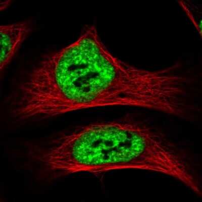 <b>Genetic Strategies Validation. </b>Immunocytochemistry/Immunofluorescence: SF3A1 Antibody [NBP1-87215] - Immunofluorescent staining of human cell line U-2 OS shows localization to nuclear speckles.