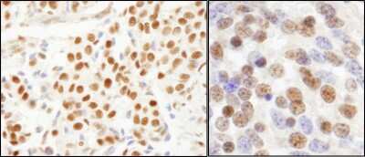 <b>Independent Antibodies Validation and Biological Strategies Validation.</b>Immunohistochemistry: SF3A1 Antibody [NB100-79843] - Sample: FFPE sections of human breast carcinoma (left) and mouse teratoma (right). Antibody: Affinity purified rabbit anti- SF3a120/SAP114 used at a dilution of 1:200 (1 ug/ml). Detection: DAB