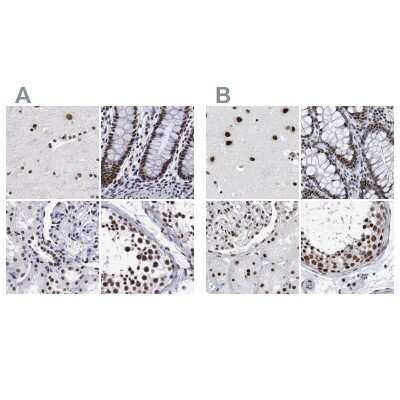 <b>Independent Antibodies Validation. </b>Immunohistochemistry-Paraffin: SF3A1 Antibody [NBP1-87214] - Staining of human cerebral cortex, colon, kidney and testis using Anti-SF3A1 antibody NBP1-87214 (A) shows similar protein distribution across tissues to independent antibody NBP1-87215 (B).