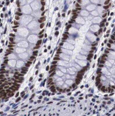 Immunohistochemistry-Paraffin: SF3A1 Antibody [NBP1-87214] - Staining of human colon using Anti-SF3A1 antibody.