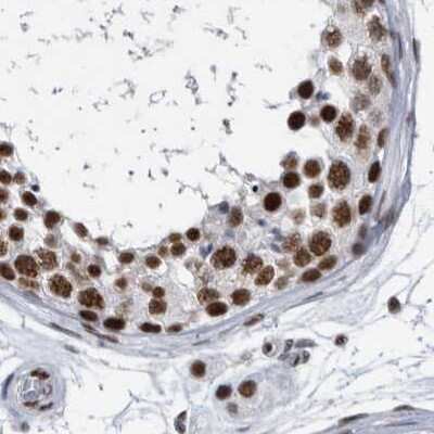 Immunohistochemistry-Paraffin: SF3A1 Antibody [NBP1-87215] - Staining of human testis.