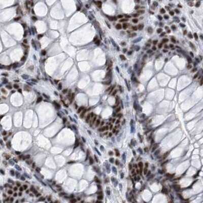 Immunohistochemistry-Paraffin: SF3A1 Antibody [NBP1-87215] - Staining of human colon.