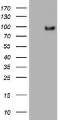 Western Blot: SF3A1 Antibody (OTI3F4) - Azide and BSA Free [NBP2-74150] - Analysis of HEK293T cells were transfected with the pCMV6-ENTRY control (Left lane) or pCMV6-ENTRY SF3A1.
