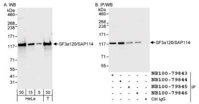 Western Blot: SF3A1 Antibody [NB100-79843] - Detection of Human SF3a120/SAP114 on HeLa whole cell lysate using NB100-79843. SF3a120/SAP114 was also IPed by rabbit  anti-SF3a120/SAP114 antibodies NB100-79844, NB100-79845, and NB100-79846.