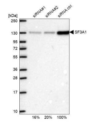 Western Blot: SF3A1 Antibody [NBP1-87215] - Analysis in U2OS cells transfected with control siRNA, target specific siRNA probe #1 and #2. Remaining relative intensity is presented.