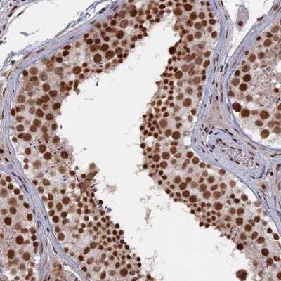 Immunohistochemistry: SF3A2 Antibody [NBP2-48775] - Staining of human testis shows strong nuclear positivity in cells in seminiferus ducts.