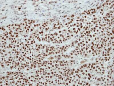 Immunohistochemistry-Paraffin: SF3A2 Antibody [NBP2-15106] - J5 xenograft, using SAP62 antibody at 1:100 dilution. Antigen Retrieval: Citrate buffer, pH 6.0, 15 min.