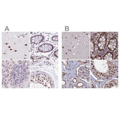 Immunohistochemistry-Paraffin SF3A2 Antibody