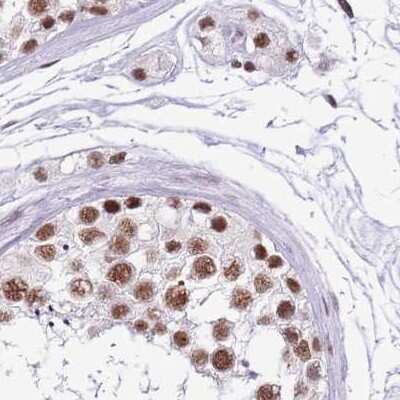 Immunohistochemistry-Paraffin: SF3A2 Antibody [NBP2-47281] - Staining of human testis.