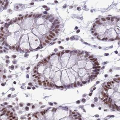 Immunohistochemistry-Paraffin: SF3A2 Antibody [NBP2-47281] - Staining of human colon.