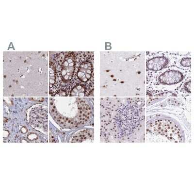 <b>Independent Antibodies Validation. </b>Immunohistochemistry-Paraffin: SF3A2 Antibody [NBP2-48775] - Staining of human cerebral cortex, colon, kidney and testis using Anti-SF3A2 antibody NBP2-48775 (A) shows similar protein distribution across tissues to independent antibody NBP2-47281 (B).