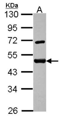 Western Blot: SF3A2 Antibody [NBP2-15106] - Sample (30 ug of whole cell lysate) A: Hela 10% SDS PAGE; antibody diluted at 1:1000.