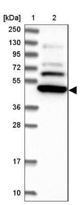 Western Blot: SF3A2 Antibody [NBP2-48775] - Lane 1: Marker [kDa] 250, 130, 95, 72, 55, 36, 28, 17, 10Lane 2: Human cell line RT-4