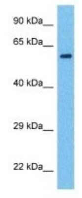 Western Blot: SF3A2 Antibody [NBP3-09943] - Western blot analysis of SF3A2 in MDA-MB-435s Whole Cell lysates. Antibody dilution at 1.0ug/ml