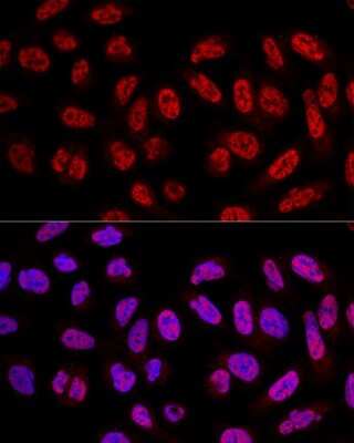 Immunocytochemistry/ Immunofluorescence SF3A3 Antibody - Azide and BSA Free