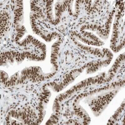 Immunohistochemistry-Paraffin: SF3A3 Antibody [NBP1-87212] - Staining of human fallopian tube shows strong nuclear positivity in glandular cells.