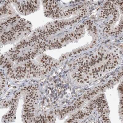 Immunohistochemistry-Paraffin: SF3A3 Antibody [NBP2-38200] - Staining of human fallopian tube shows strong nuclear positivity in glandular cells.