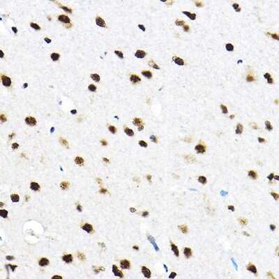 Immunohistochemistry-Paraffin SF3A3 Antibody - Azide and BSA Free